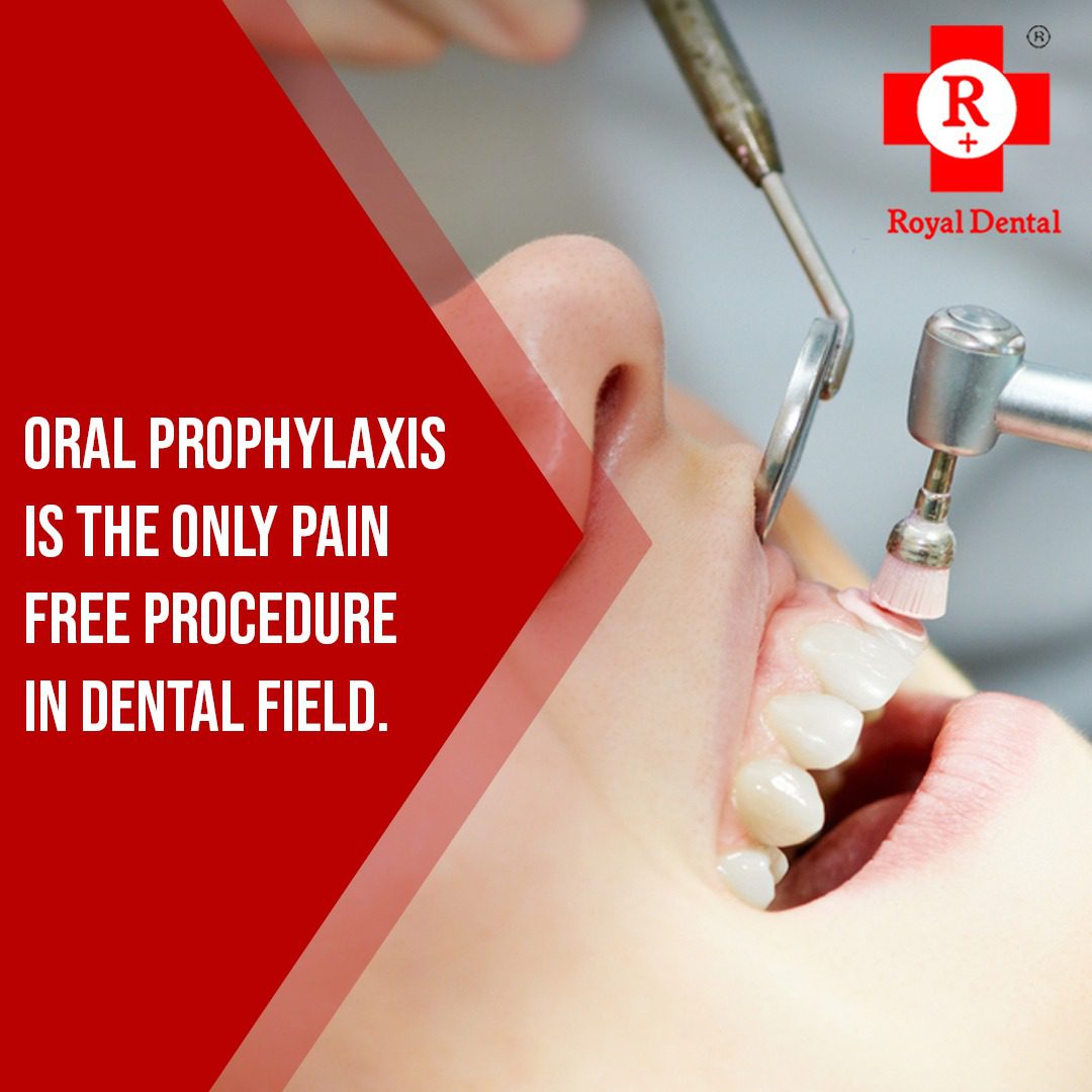What Happens During a Dental Cleaning? Step-by-Step Guide Royal Dental Clinics oral prophylaxis cleaning - What Happens During a Dental Cleaning