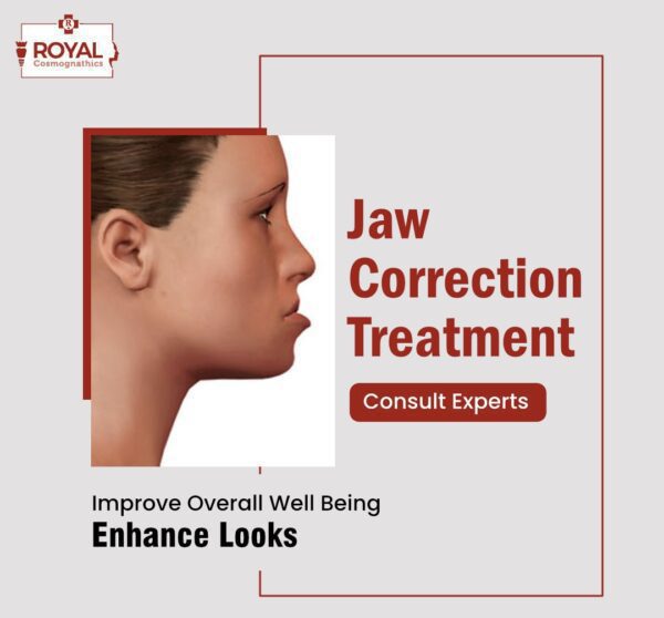 Jaw alignment