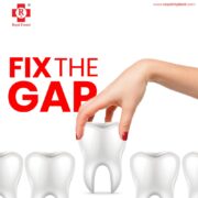 fix gap in teeth