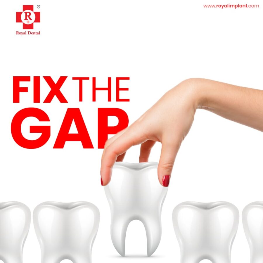 fix gap in teeth