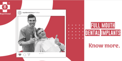 Full mouth dental implants makeover