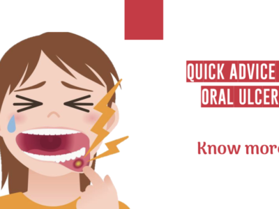 Oral and mouth ulcers