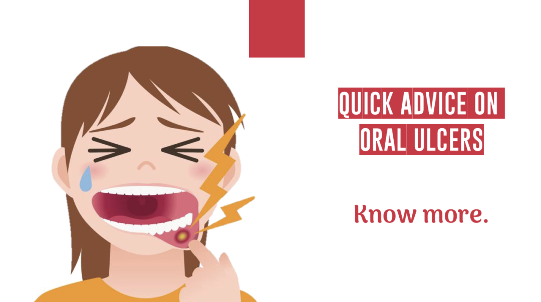 Quick Advice On Oral Ulcers In 60 Seconds Royal Dental Clinics Blog