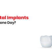 dental implants in one day reviews