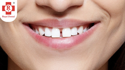 gap in teeth adolescence