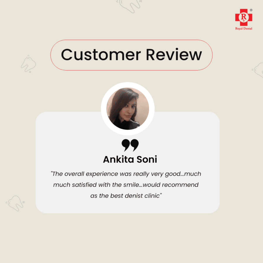 One-Day Dental Implants: Same-Day Fixed Teeth Royal Dental Clinics google review Implant reviews
