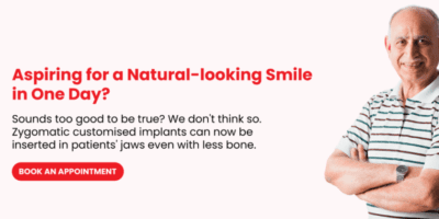 no bone missing teeth