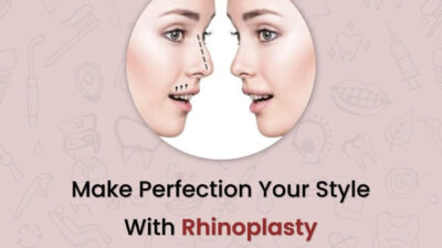 nose rhinoplasty