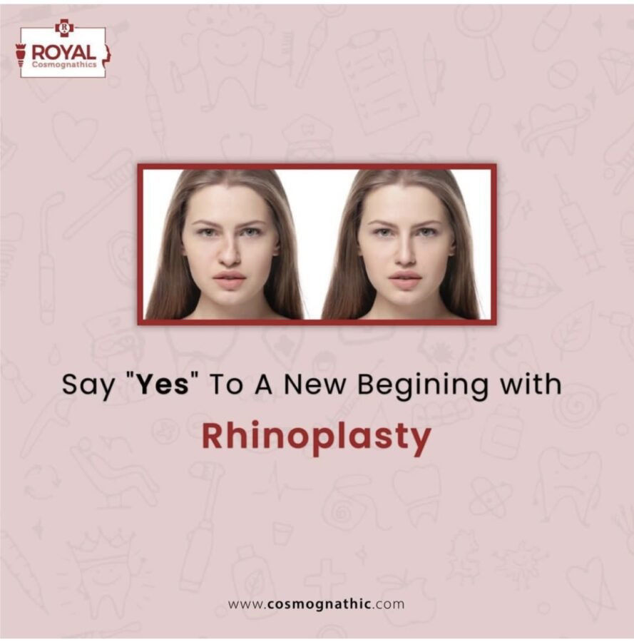 How much does a Nose Job Cost in India? Royal Dental Clinics rhinoplasty nose job cost in india