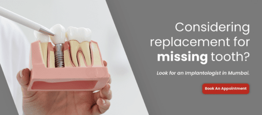 Dental Implant immediately after an Extraction
