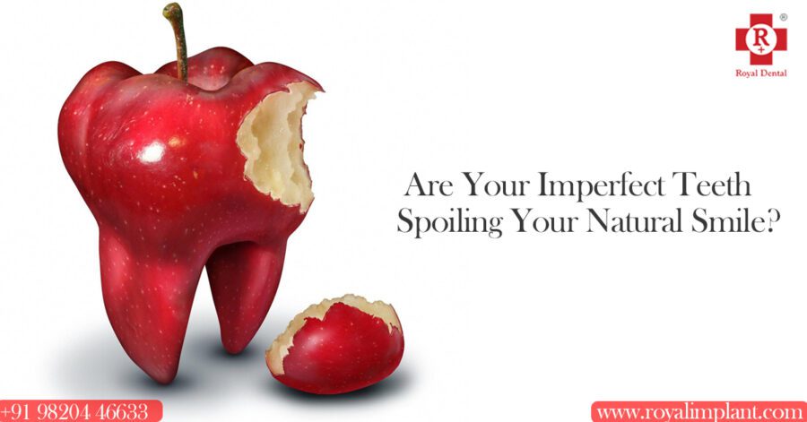 Root Canal Treatment for Kids: Parents Need to Know Royal Dental Clinics root canal treatment for kids