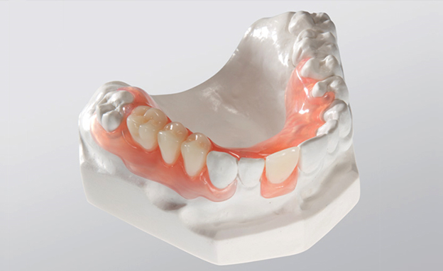 Dental cast partial denture