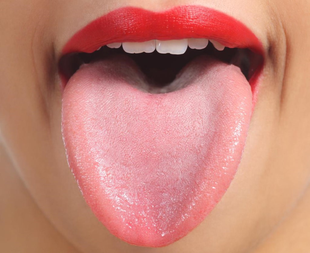 tongue dentistry