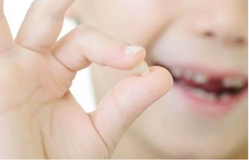 Saving a Damaged Natural Tooth Royal Dental Clinics dental tooth broke