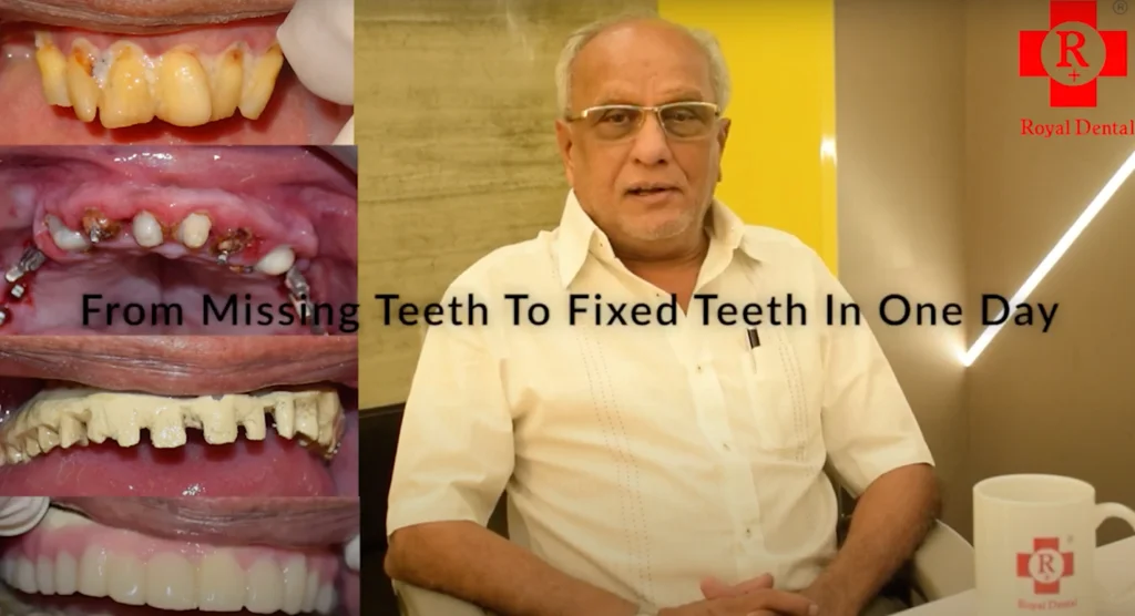 PEEK Dental Framework: Benefits After Implant Treatment Royal Dental Clinics PEEK Dental framework