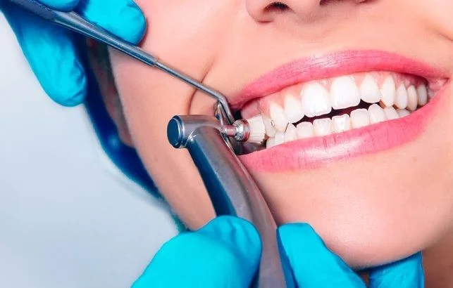 dental teeth scaling - gaps in teeth after deep cleaning