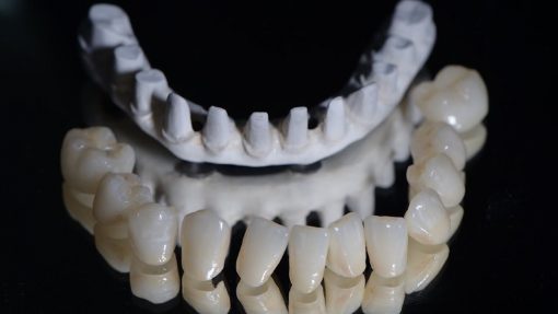 peek material dentistry