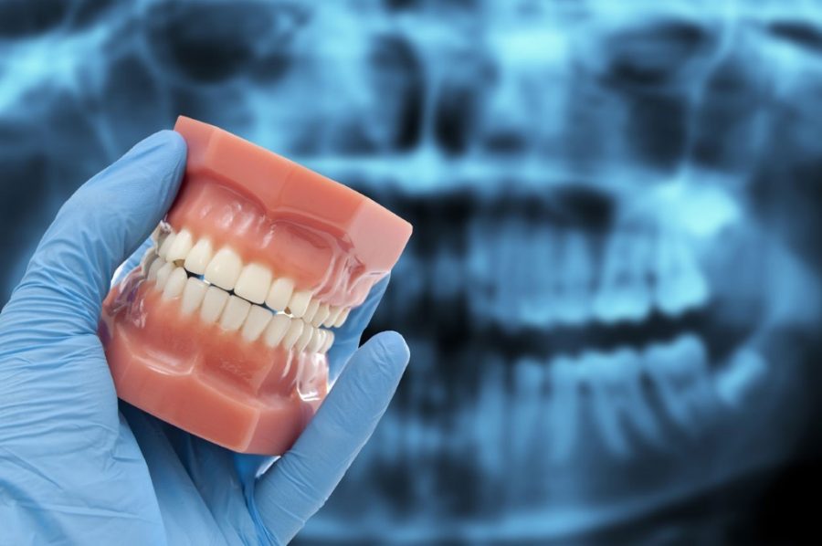 dental xray, Smiling Teeth Dental Clinic