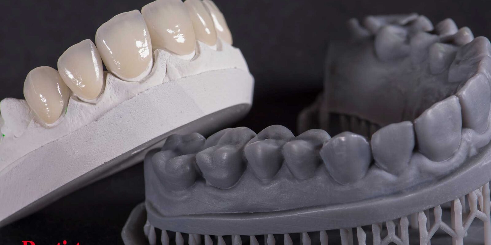3D printing in dental
