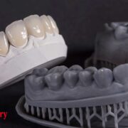 3D printing in dental