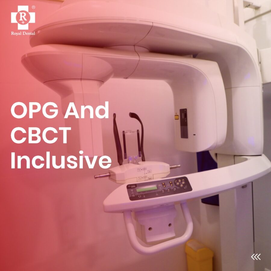 In-house CBCT X-ray