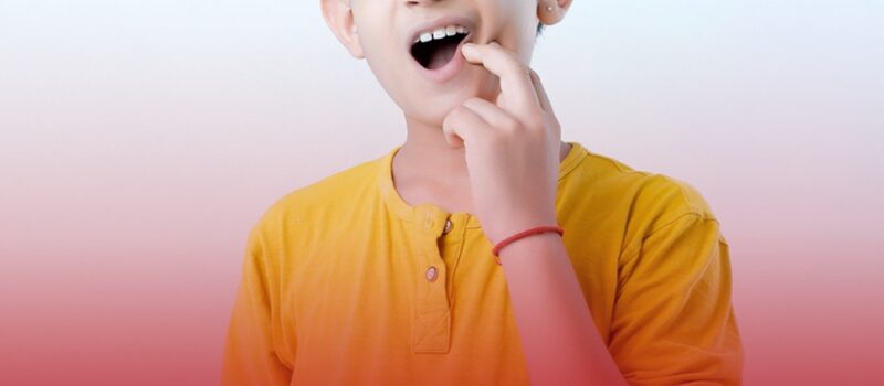 wisdom tooth extraction