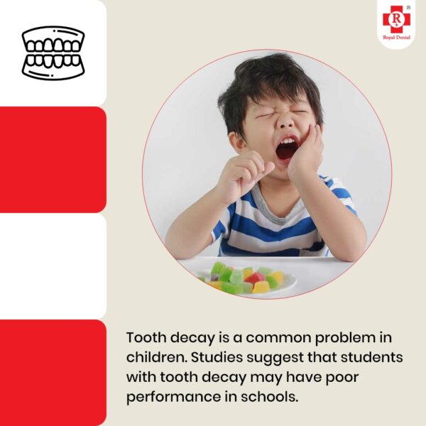 Can Tooth Decay Be Reversed? Early Decay vs Cavities