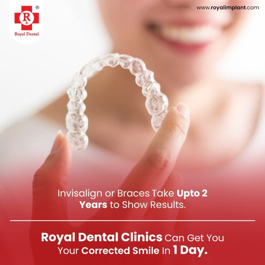 What is the Process of Invisalign Treatment? Royal Dental Clinics process of Invisalign treatment