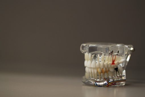 dental crown model dentist dentistry