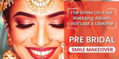 Perfect Teeth before Wedding