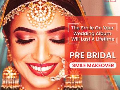 Perfect Teeth before Wedding