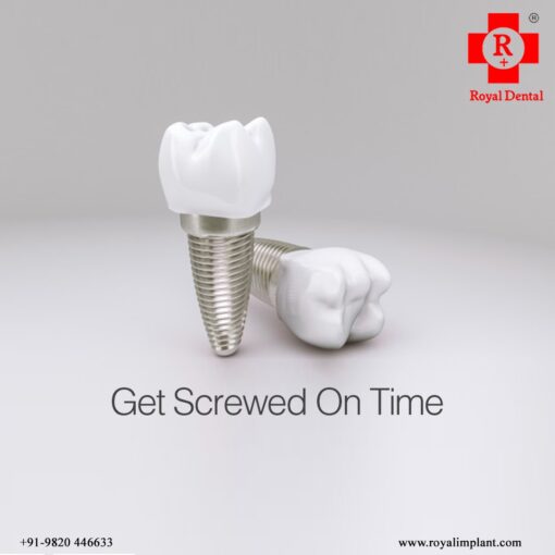 dental implant screw