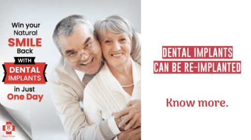 Can failed Dental Implant be replaced?