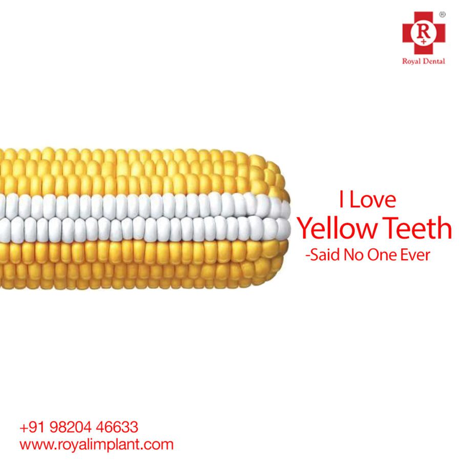 Teeth Cleaning in Mumbai: Professional Scaling Improves Smile Royal Dental Clinics yellow teeth