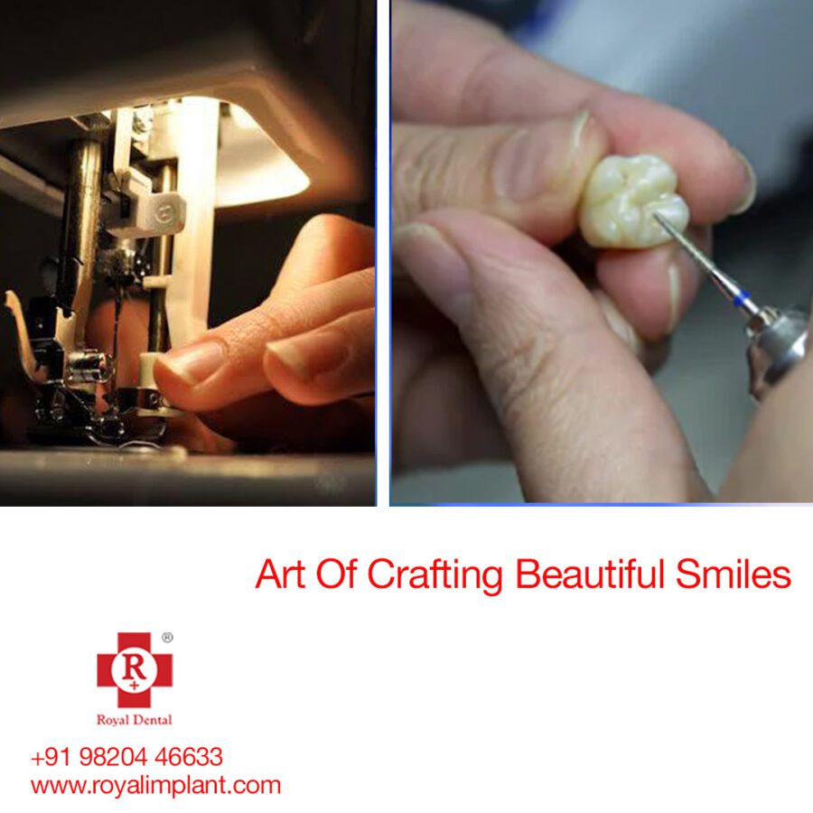 Same Day Dental Crown Treatment in Mumbai