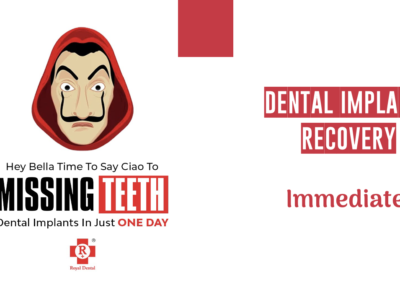 Recovery time after Dental Implants?