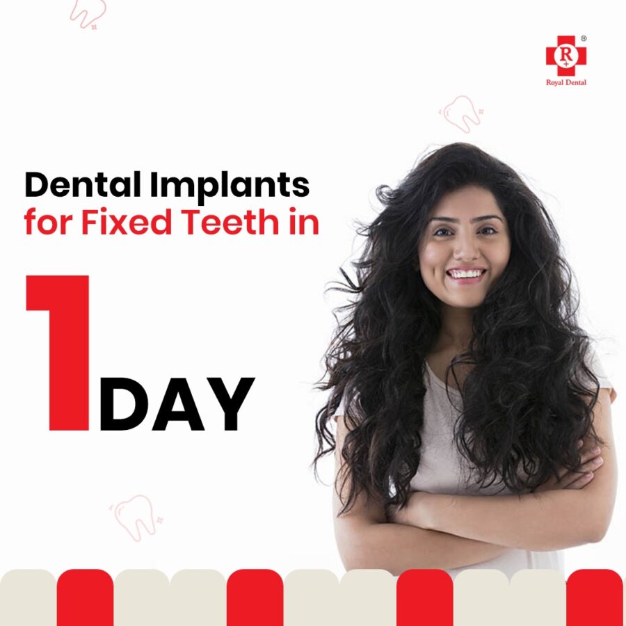 Dental-Implant-In-One-Day
