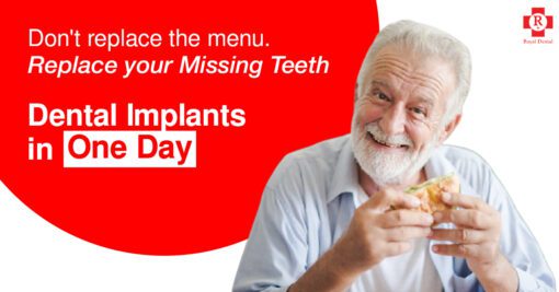 recovery dental implant - how strong are implants