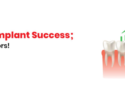 Dr Chirag Chamria Dental Implant Success