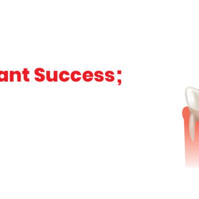 Dental Implant Treatments Successful