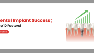 dental implant success factors