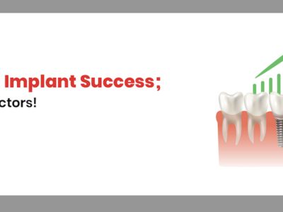 dental implant success factors