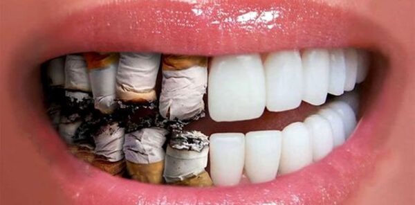 Smoking does to implant