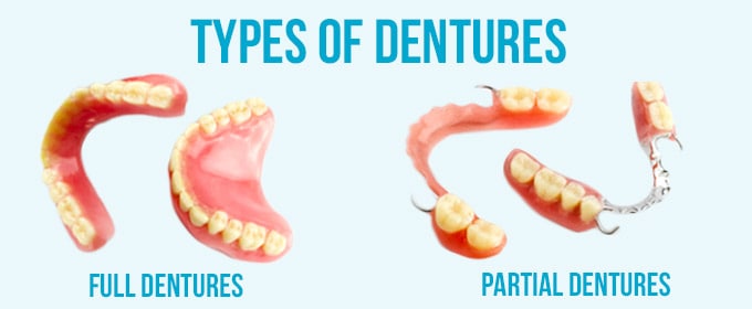 Implants-vs-Dentures