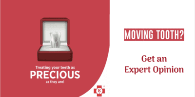 moving tooth? teeth mobility