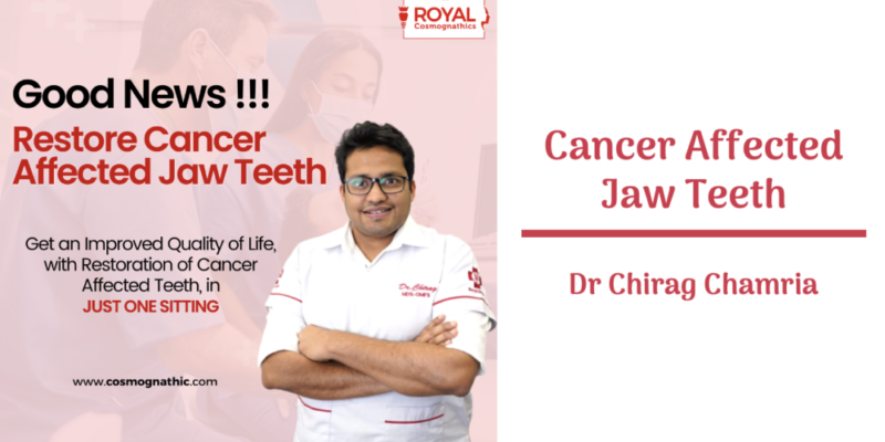 Cancer Affected Jaw Teeth