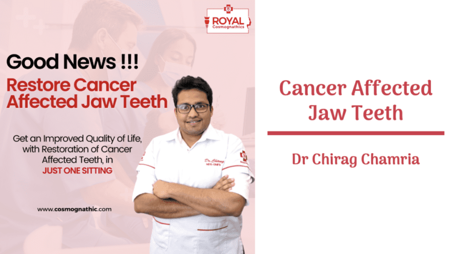 Cancer Affected Jaw Teeth