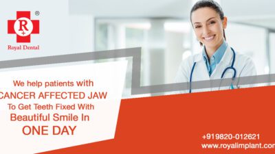 Fixed Teeth After Oral Cancer Surgery: Implants, Reconstruction and Recovery Royal Dental Clinics Dental Health Education Cancer affected Jaw Teeth rehabilitation after cancer