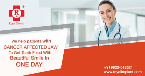 Cancer-affected Jaw Teeth rehabilitation after cancer