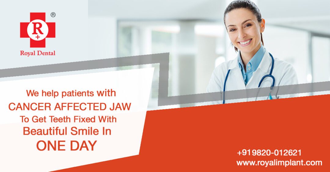 Cancer affected Jaw Teeth rehabilitation after cancer